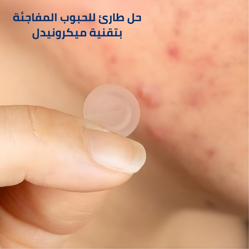 باتش ميكرونيدل للحبة المفاجئة