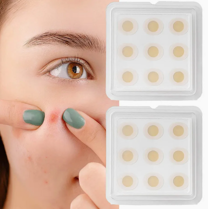 باتش ميكرونيدل للحبة المفاجئة