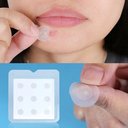 باتش ميكرونيدل للحبة المفاجئة